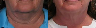 before and after image