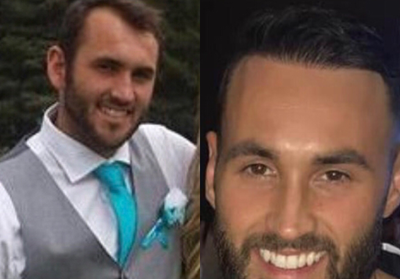 Hair Transplant before and after photo