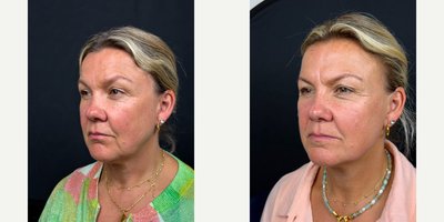 before and after image