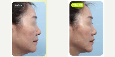 before and after image