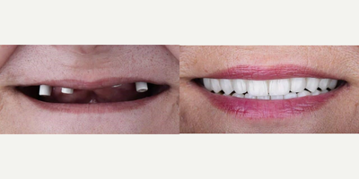 before and after image