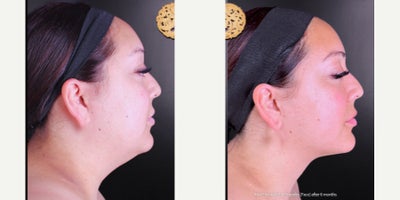 before and after image