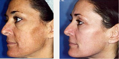 before and after image