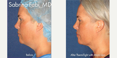 before and after image