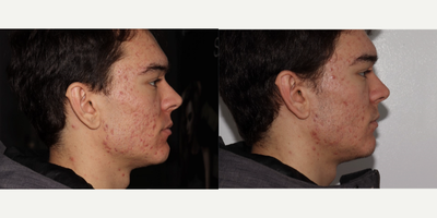 before and after image