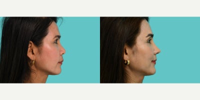before and after image