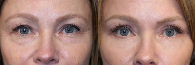 before and after image
