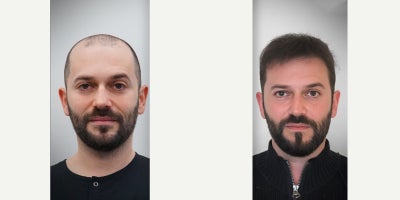 before and after image