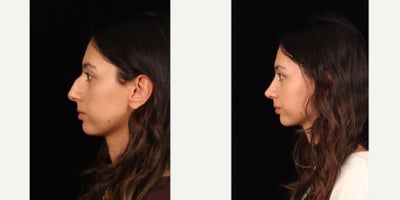 before and after image