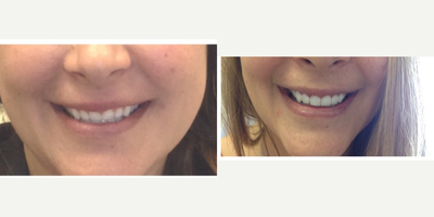 before and after image