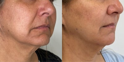 before and after image
