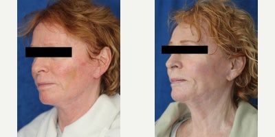 before and after image