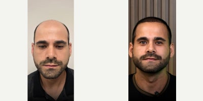 before and after image
