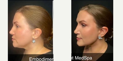 before and after image