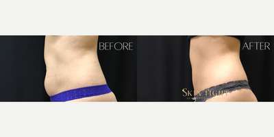 before and after image