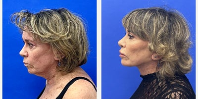 before and after image