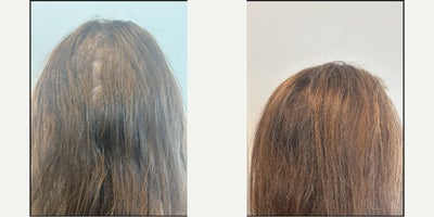 before and after image