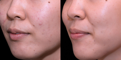 before and after image