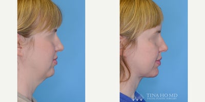 before and after image