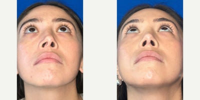 before and after image