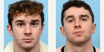 before and after image