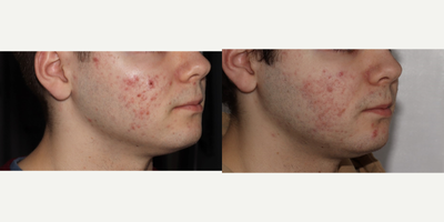 before and after image