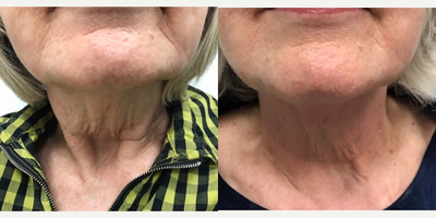 before and after image