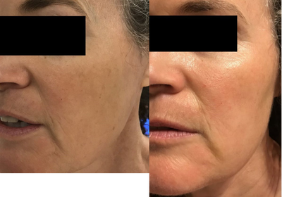 before and after image