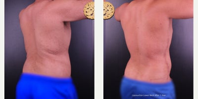 before and after image