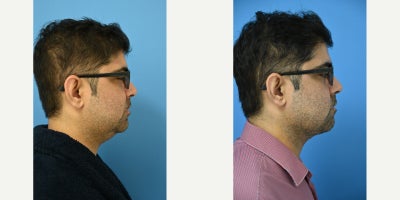 before and after image