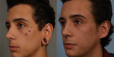 before and after image