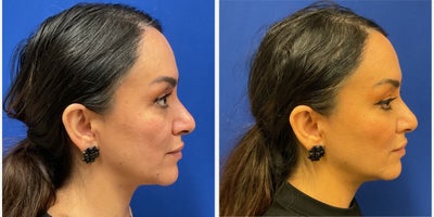 before and after image