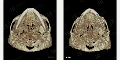 before and after image