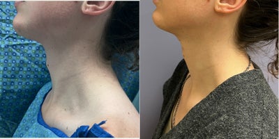 before and after image