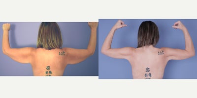 before and after image