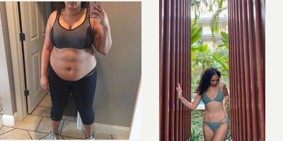 Gastric Sleeve Surgery before and after photo