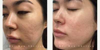 before and after image