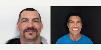 before and after image