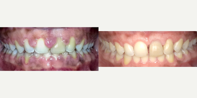 before and after image