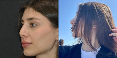 before and after image