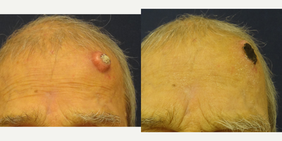 before and after image