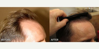 before and after image