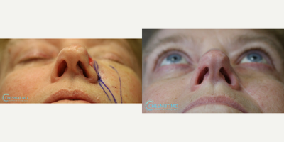 before and after image