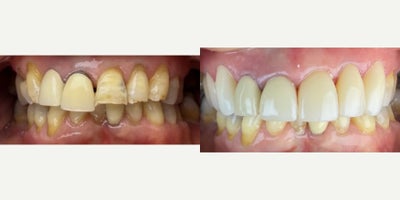 before and after image