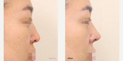 before and after image