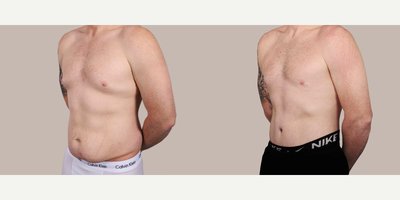 before and after image