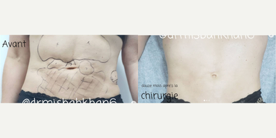 before and after image