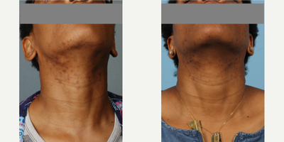 before and after image