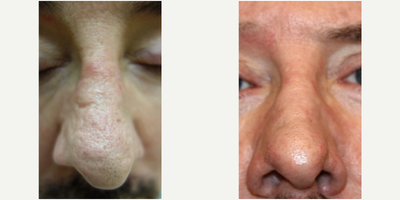 before and after image