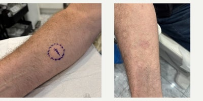 before and after image